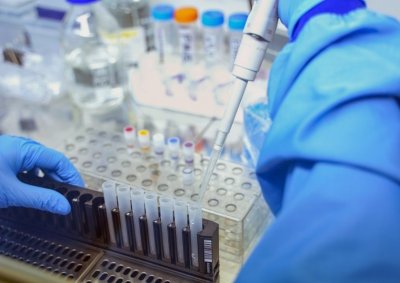 Добрич търси специалисти за работа в лаборатория за PCR тестове
