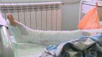 Лекари в столичната болница "Св. Анна" спасиха крака на жена след тежка катастрофа